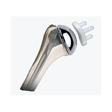Bigliani/Flatow Shoulder: image from Zimmer